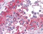 COMT Antibody (Internal)